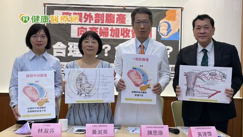 自費「腹膜外剖腹產」遭踢爆違法 衛福部：依法查辦-大出血