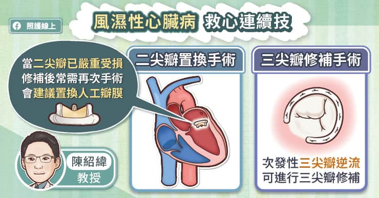 風濕性心臟病恐致中風、心衰竭！救心連續技，二尖瓣置換、三尖瓣修補、心房顫動電燒、左心耳閉合術，心臟外科醫師圖文解析-小中風