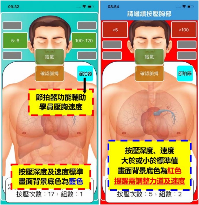 急救訓練模組「安妮」落伍了！北榮研發「阿榮」，讓急救訓練更準確、更有效率-CPR