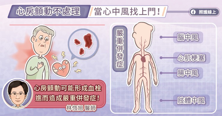 心房顫動很危險！即使沒症狀，也可能中風，治療保養重點提醒，心臟科醫師圖文解說-中風