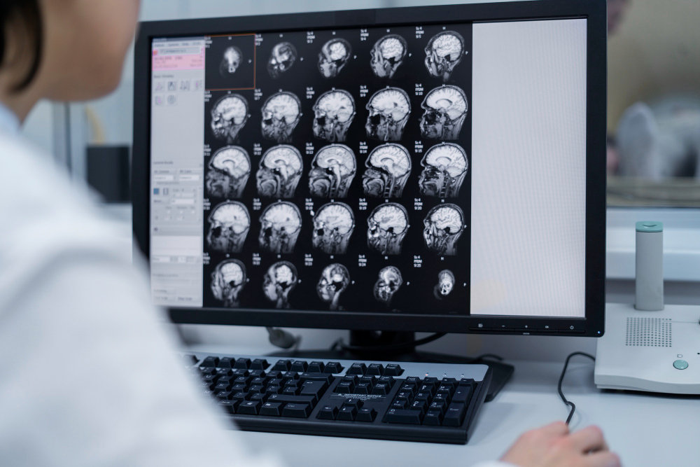 科學家研究腦細胞關閉機制 推出可早期檢測阿茲海默症血檢-PTSD