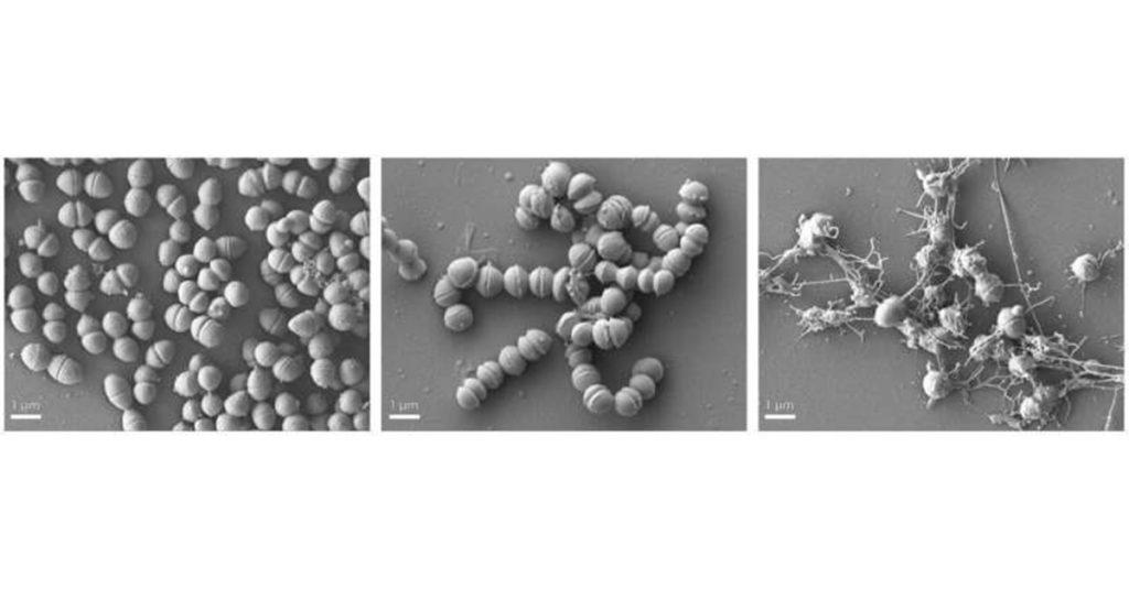 70 年老藥大變身：科學家讓抗生素威力飆升 100 倍-抗生素