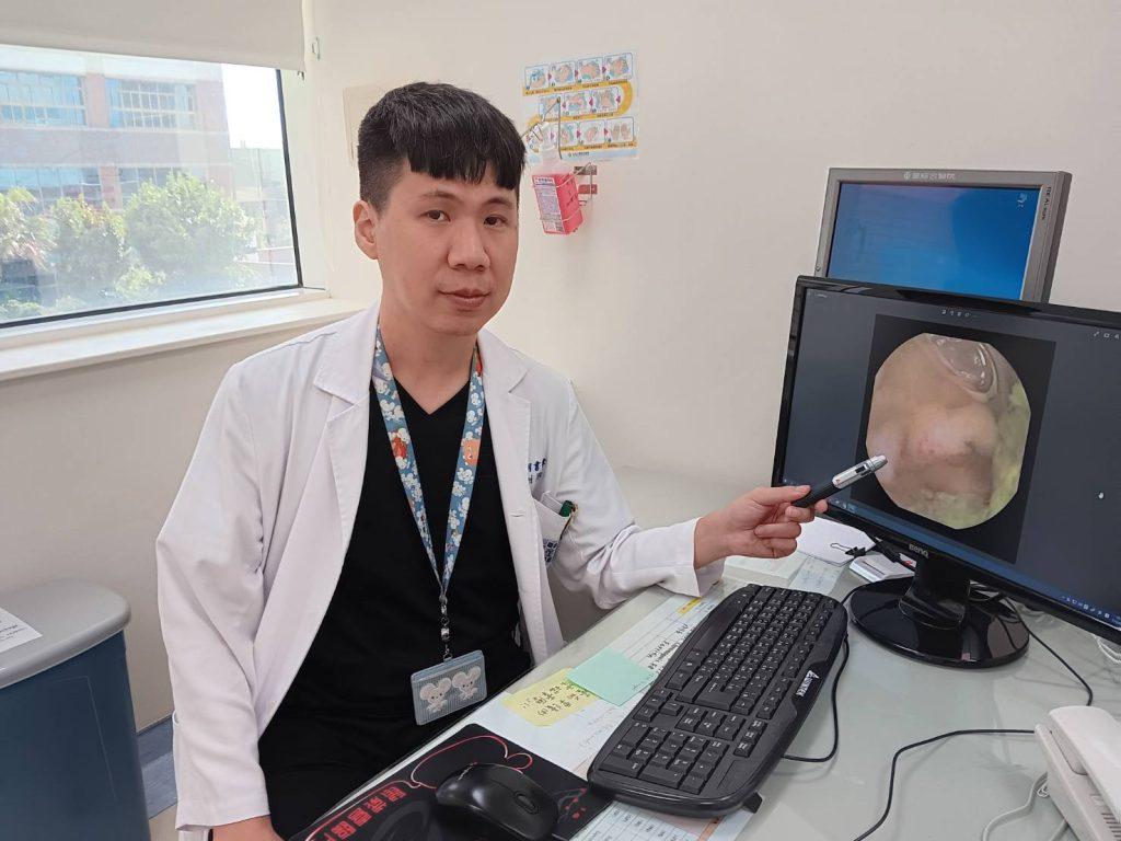 6歲孩童血便驚人！膠囊內視鏡揭露克隆氏症真相-克隆氏症