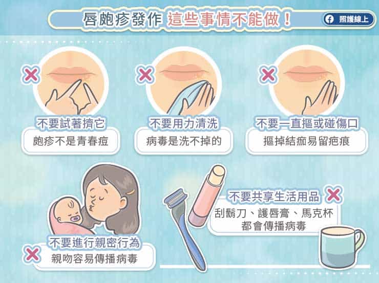 嘴唇刺痛燒灼感？小心！唇皰疹可能找上門｜嘴唇冒出痛痛小水泡，這些事情不能做（圖文懶人包）-水泡