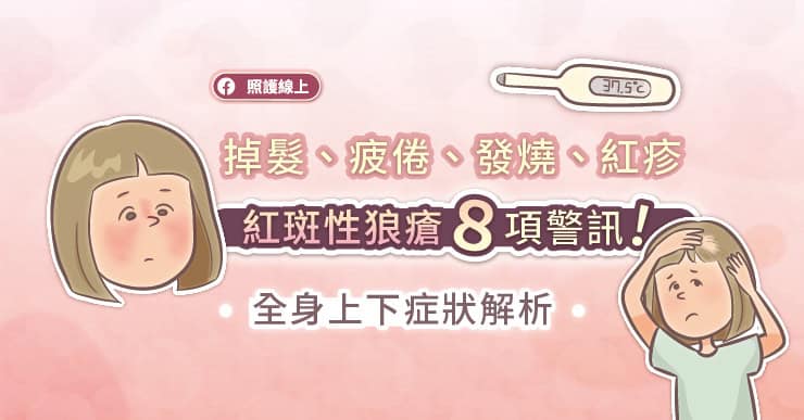 掉髮、疲倦、發燒、紅疹，女性隱形殺手紅斑性狼瘡８項警訊！｜圖文懶人包-SLE
