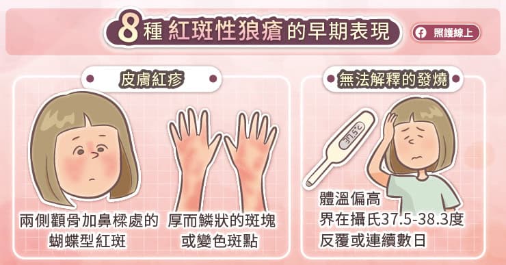 掉髮、疲倦、發燒、紅疹，女性隱形殺手紅斑性狼瘡８項警訊！｜圖文懶人包-SLE