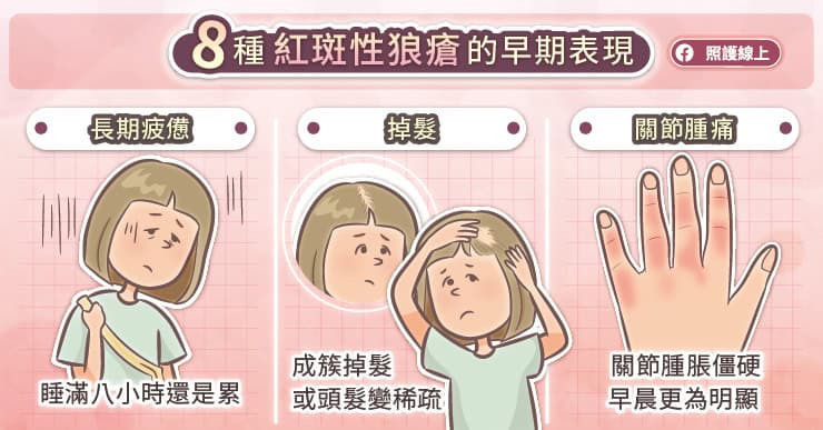 掉髮、疲倦、發燒、紅疹，女性隱形殺手紅斑性狼瘡８項警訊！｜圖文懶人包-SLE