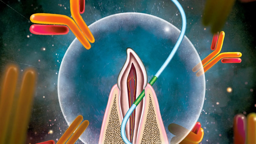 未來不用害怕打針了！科學家研發「牙線疫苗」 取代針頭瞄準牙齦-上皮附著